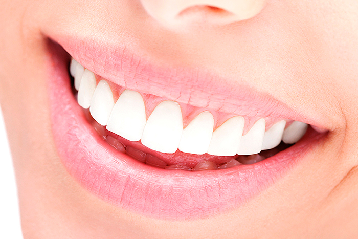 Blanqueamiento dental Algeciras